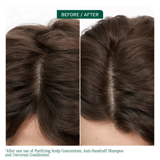 BIOLAGE Scalp Sync Purifying Scalp Concentrate for All Scalp Types