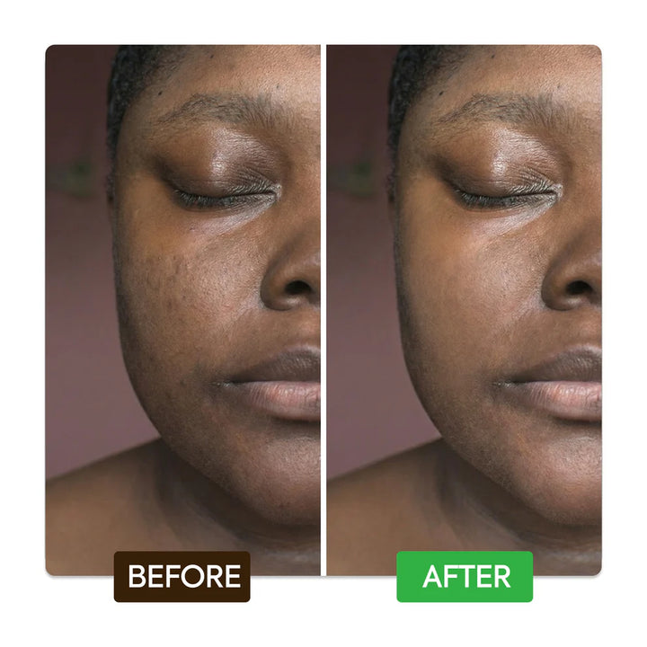 Makari KOJIC & AZELAIC BRIGHTENING SERUM