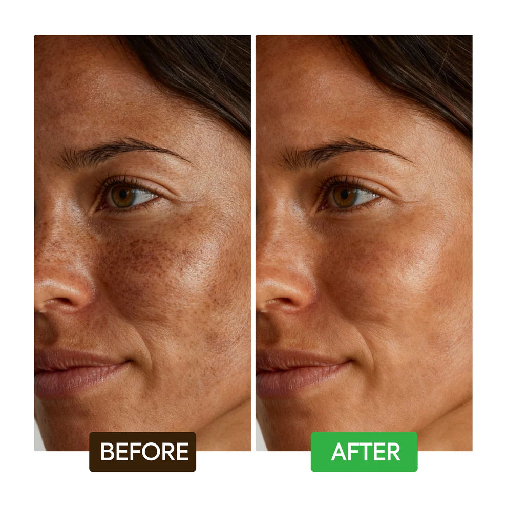 Makari KOJIC ACID DARK SPOT REMOVER SOAP BARS