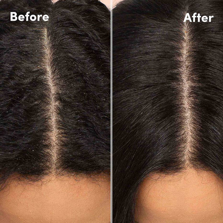 Mizani Scalp Care Hydrating Shampoo 16OZ