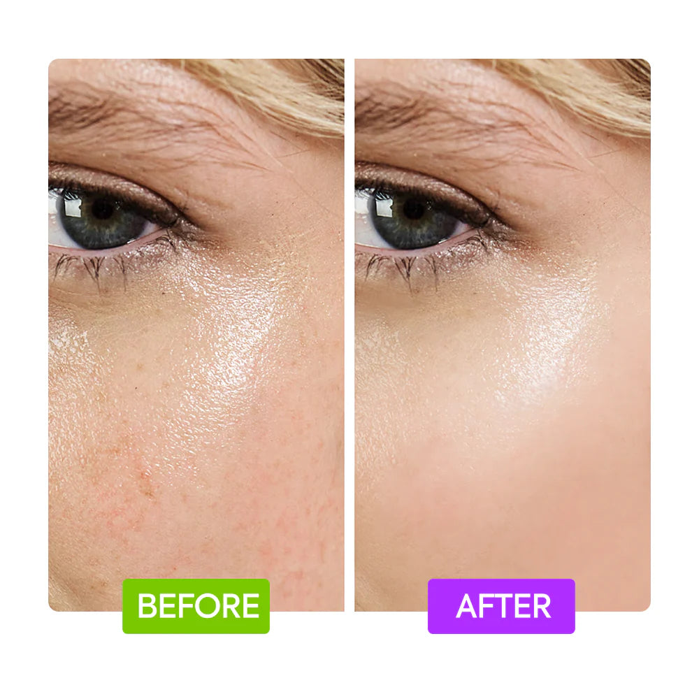 IYKYK By Makari 20% AHA + 10% NIACINAMIDE BOOSTER