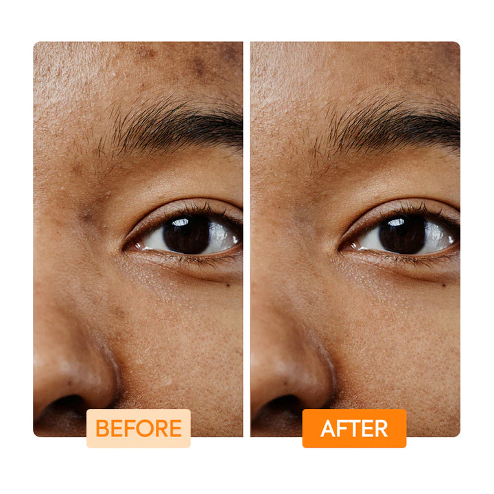 IYKYK By Makari VITAMIN C & TURMERIC FACIAL CLEANSING BAR