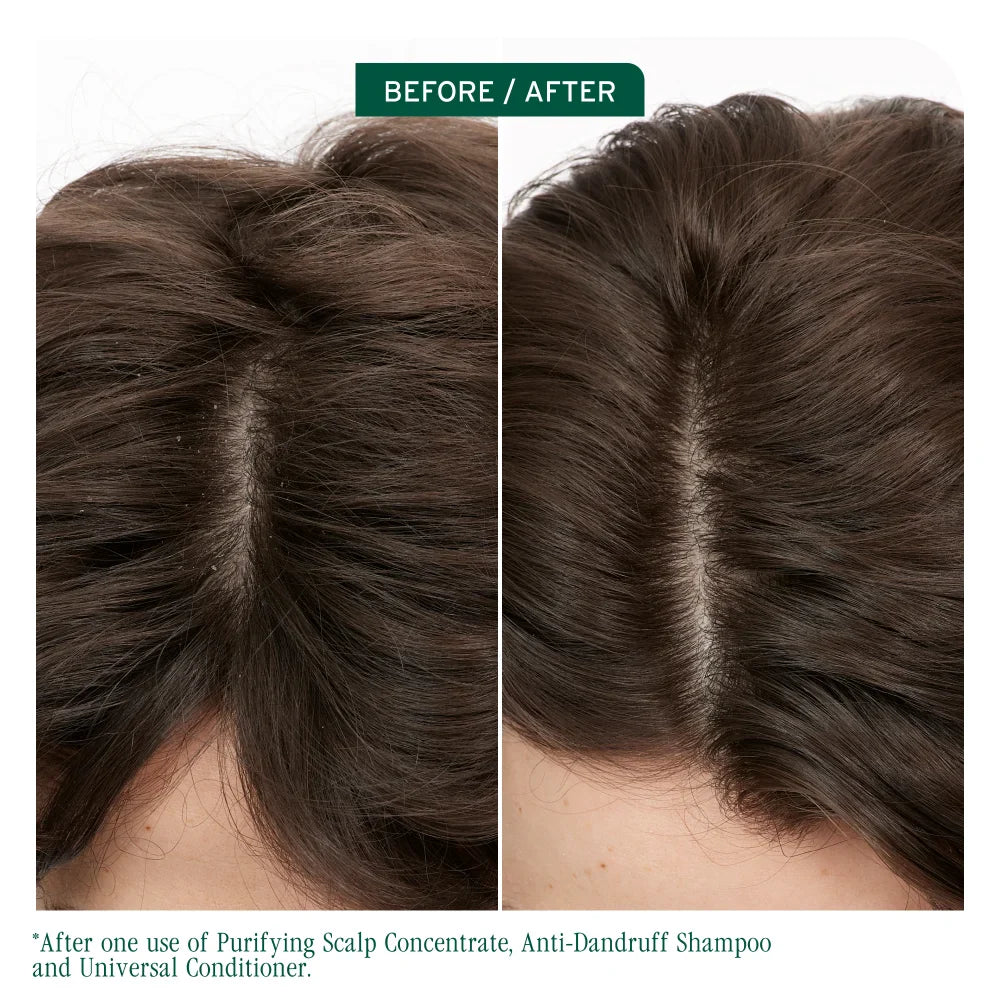 BIOLAGE Scalp Sync Anti-Dandruff Shampoo