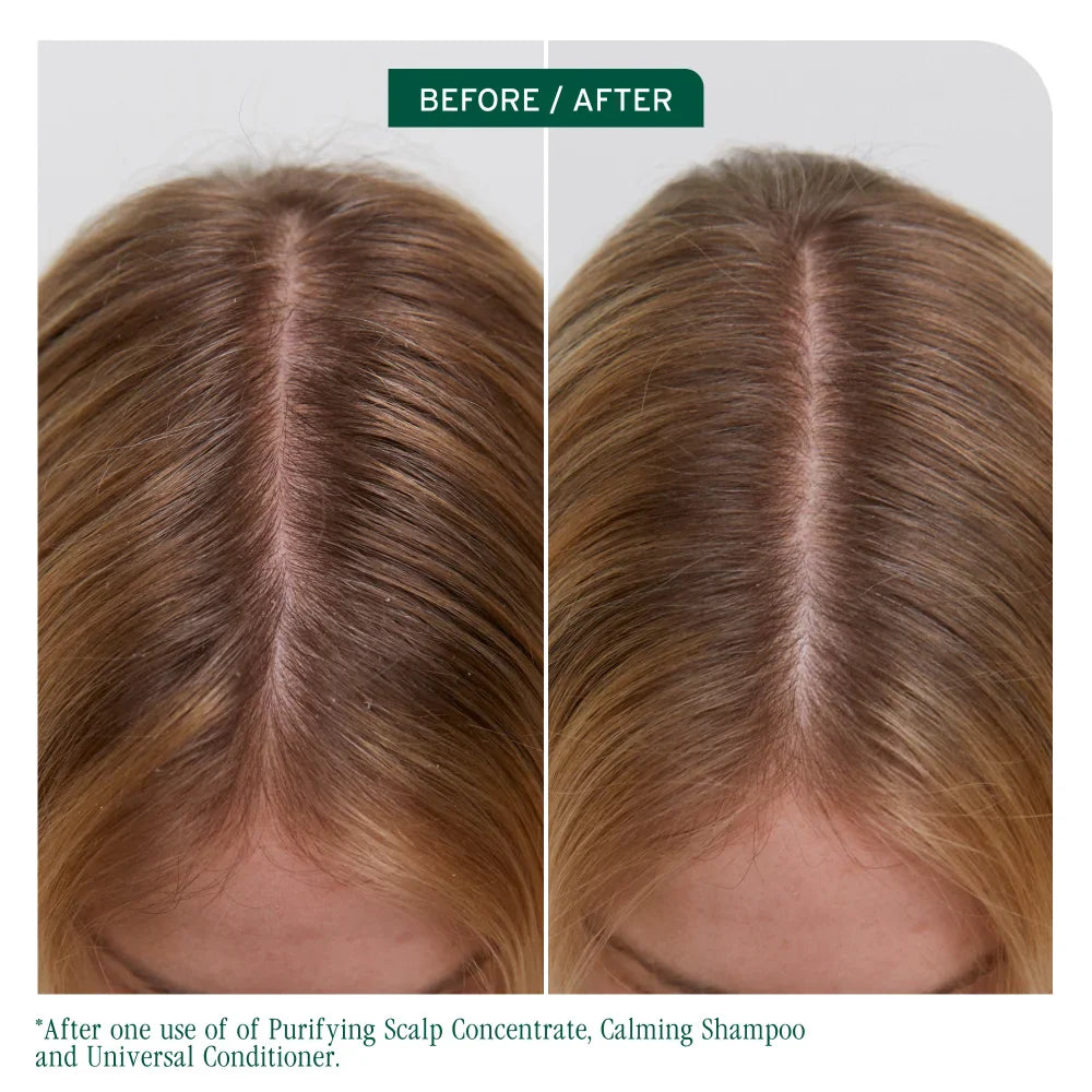 BIOLAGE Scalp Sync Universal Conditioner