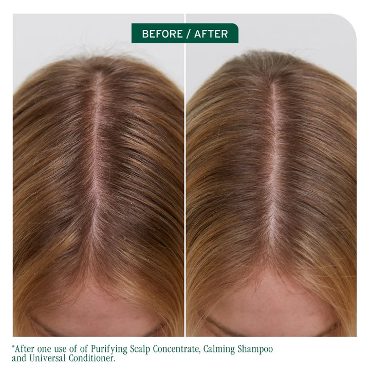 BIOLAGE Scalp Sync Universal Conditioner