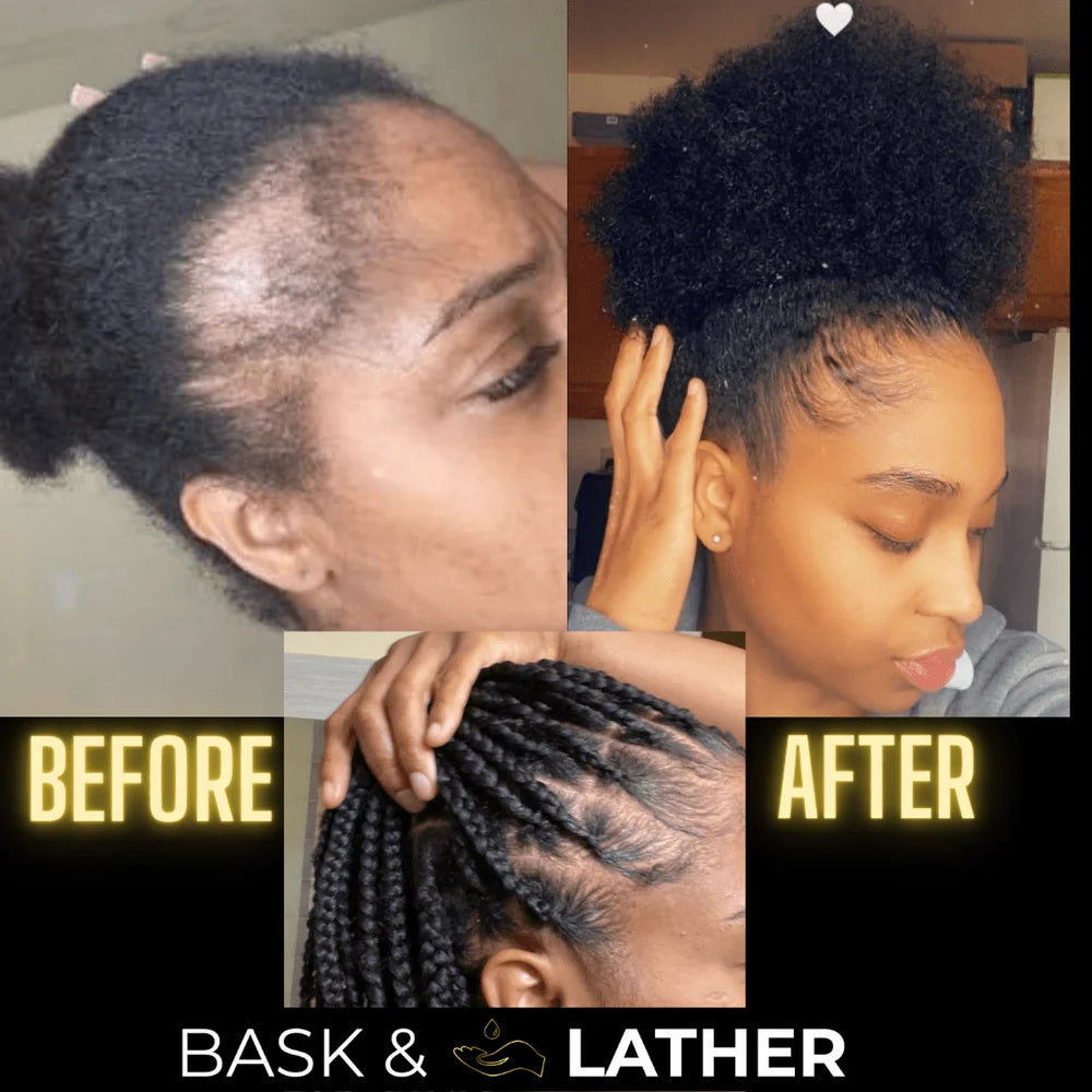 Bask & Lather Scalp Stimulator | Hair Growth Oil