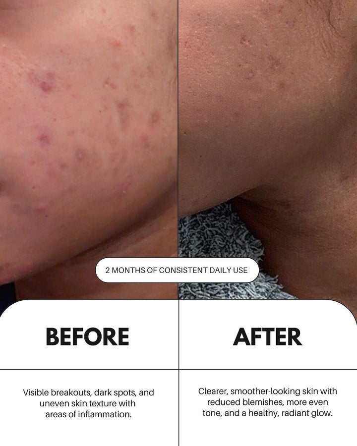 As I Am Vitamin C Serum For Face