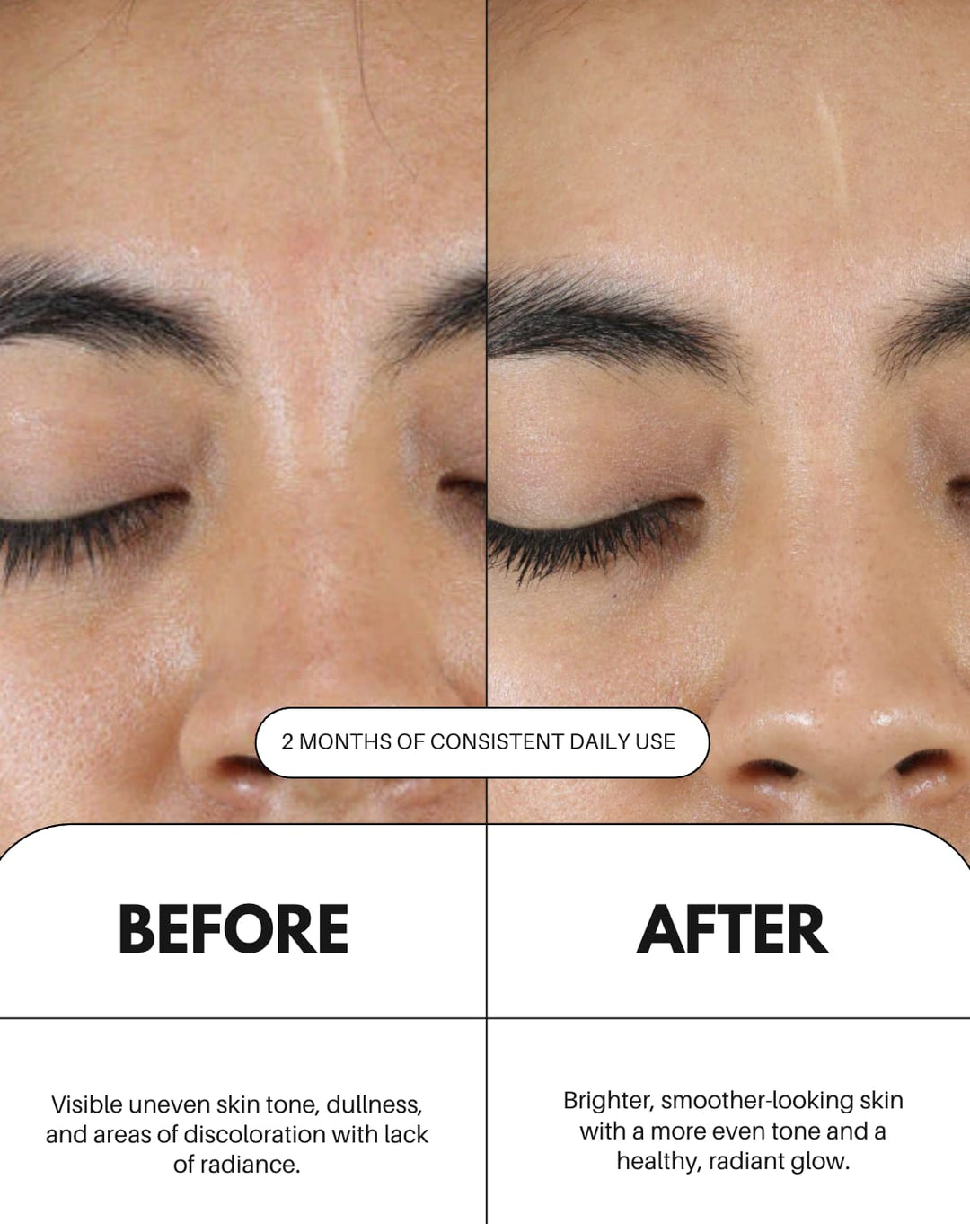 As I Am Vitamin C Serum For Face