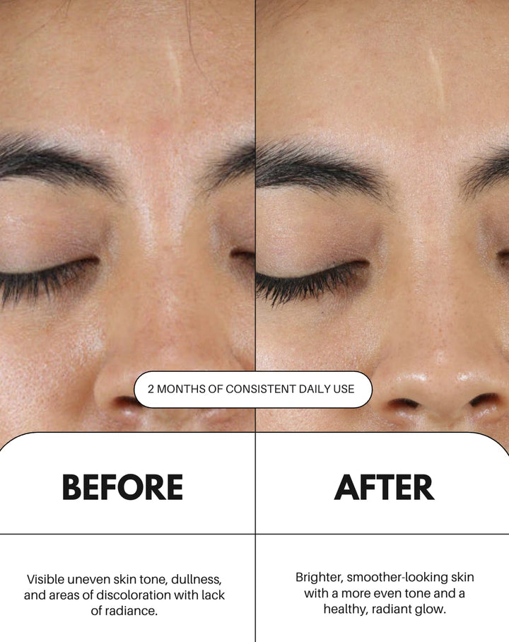 As I Am Vitamin C Serum For Face
