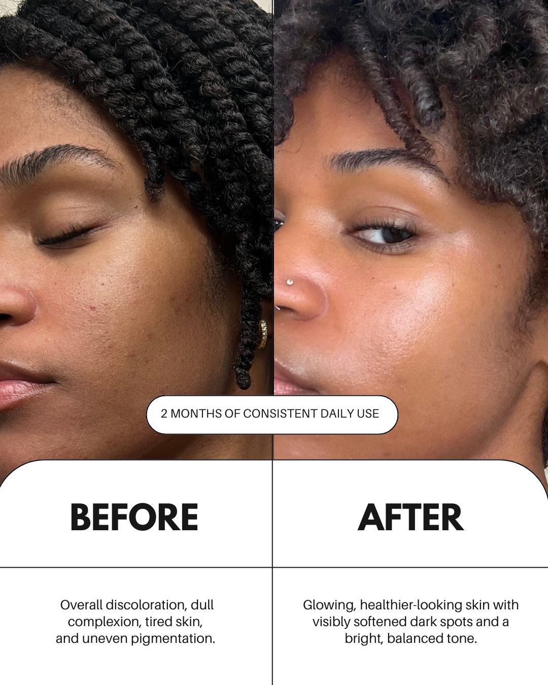 As I Am Vitamin C Serum For Face